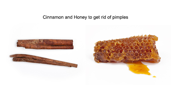 Cinnamon and honey to get rid of pimples