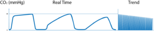 What is Capnography?, Indications, Uses and Interpretations. | Holistic ...