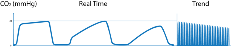 What is Capnography?, Indications, Uses and Interpretations. | Holistic ...