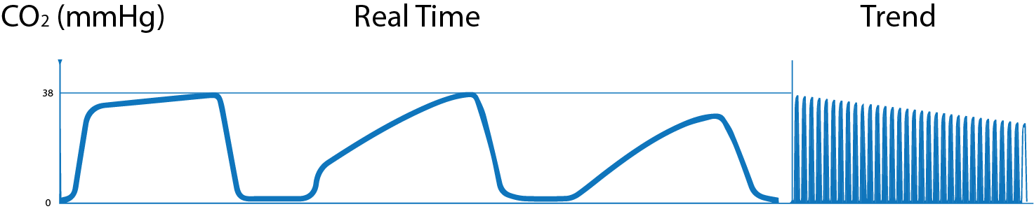 What is Capnography?, Indications, Uses and Interpretations. | Holistic ...