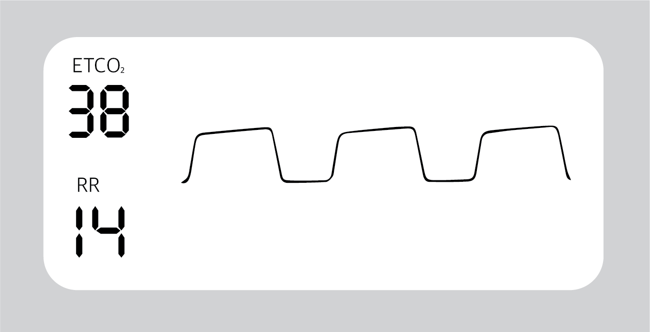 What Is Capnography?, Indications, Uses And Interpretations. | Holistic ...