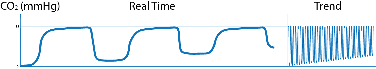 What is Capnography?, Indications, Uses and Interpretations. | Holistic ...