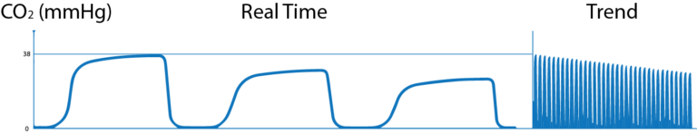 What Is Capnography?, Indications, Uses And Interpretations. 