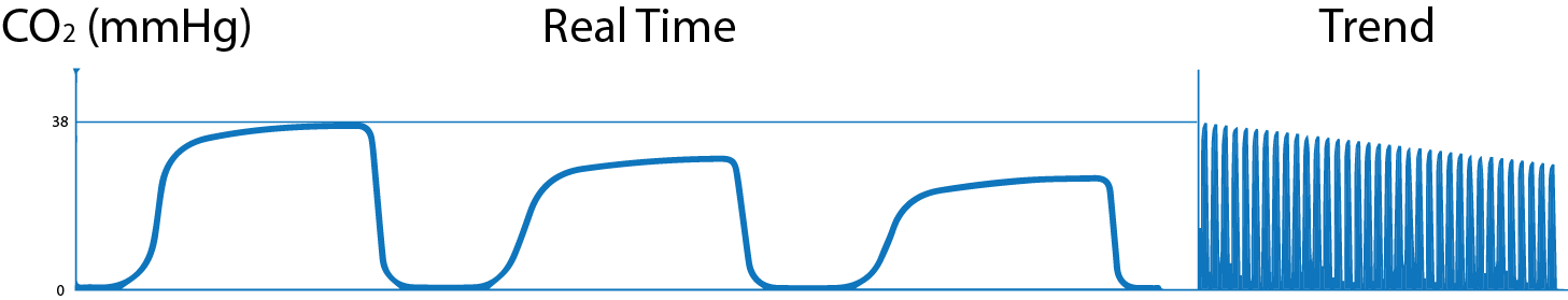 What is Capnography?, Indications, Uses and Interpretations. | Holistic ...