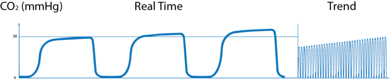 What is Capnography?, Indications, Uses and Interpretations. | Holistic ...