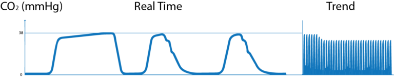 What is Capnography?, Indications, Uses and Interpretations. | Holistic ...