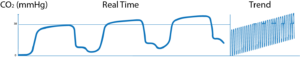 What Is Capnography?, Indications, Uses And Interpretations. 