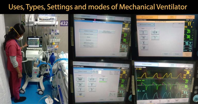 Mechanical Ventilator